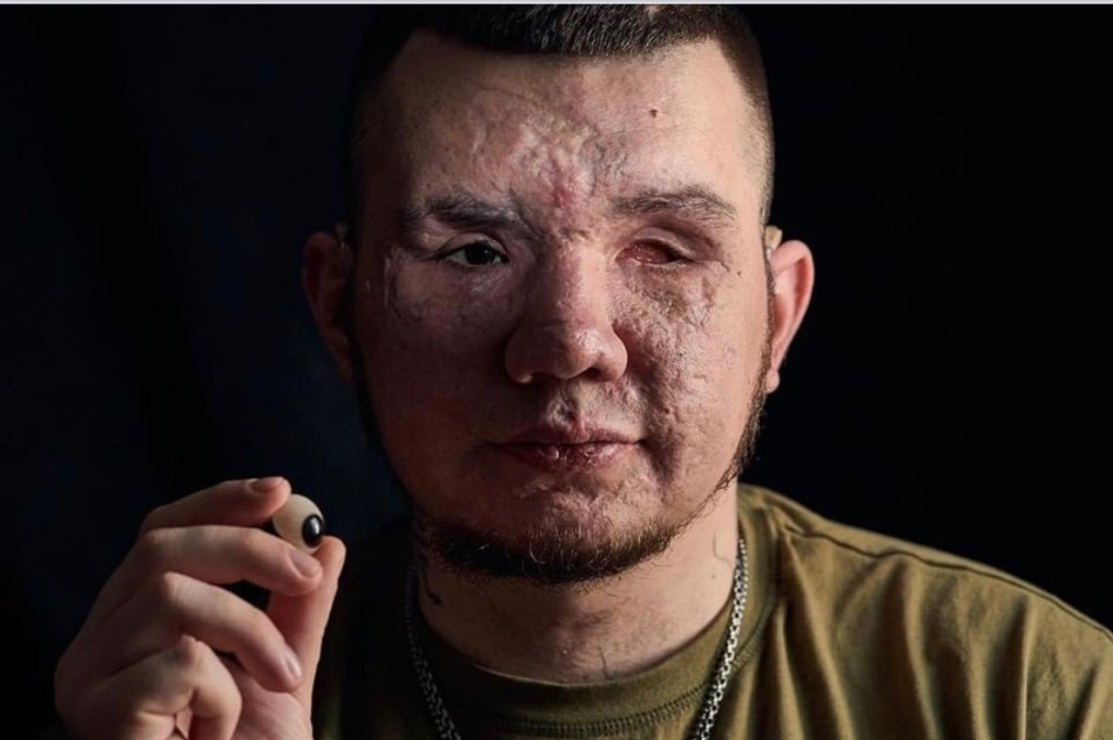 3/24/2023 – A hero of Ukraine will not give&nbsp;up