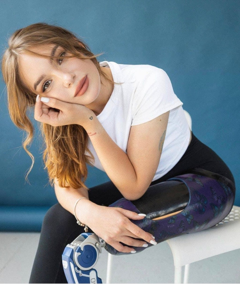 8/29/2023 – “I want to show you that being beautiful and happy is possible, regardless of anything!”