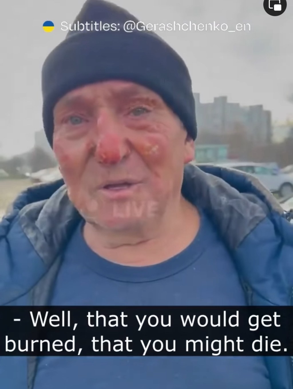 1/1/2024 – A man in Kyiv jumped into a car that was burning from a Russian missile attack and drove it away from other cars&nbsp;(video)