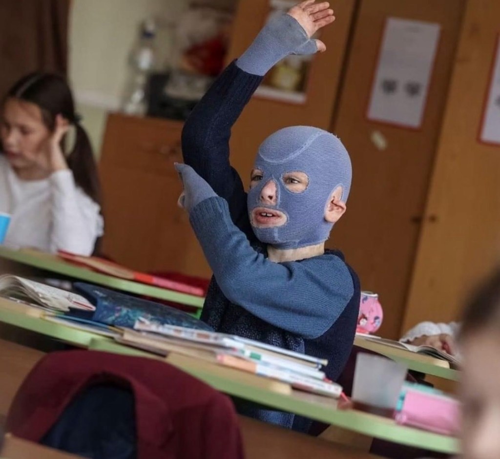 3/19/2024 – The cruelty of Russia knows no limit. They find lots of ways to destroy the next generation of&nbsp;Ukrainians…